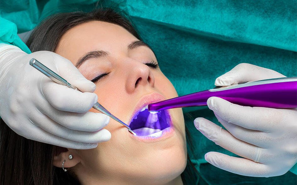 Fluoride Treatments in Winfield, IL