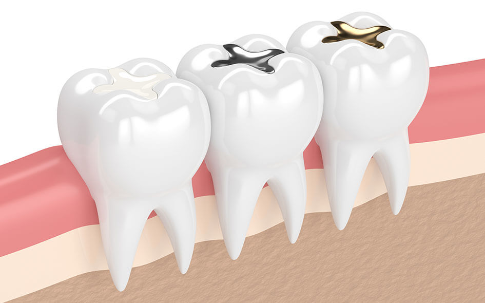 Pediatric Restoration Procedures in Winfield, IL
