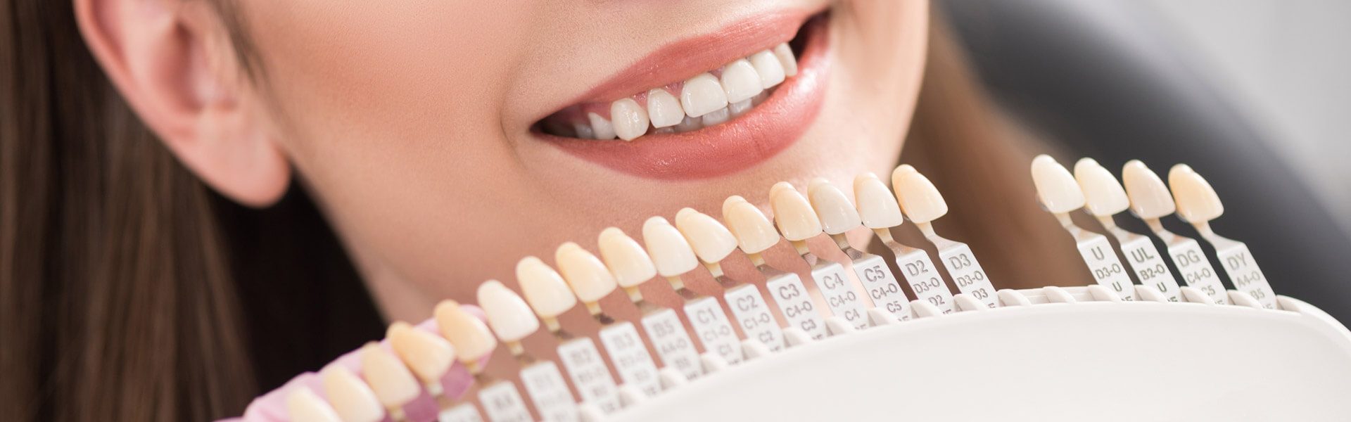 A Closer Look at Dental Veneers